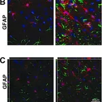 Merck Anti-Glial Fibrillary Acidic Protein Antibody, clone GA5