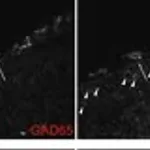 Merck Anti-GAD67 Antibody, clone 1G10.2