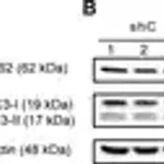 Merck Anti-LC3 antibody produced in rabbit
