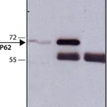 Merck Anti-p62/SQSTM1 antibody produced in rabbit