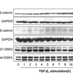 Merck Anti-Active-β-Catenin (Anti-ABC) Antibody, clone 8E7