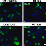 Merck Anti-MAP2 Antibody, clone AP20