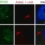 Merck Anti-RPGR antibody produced in rabbit