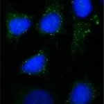 Merck Anti-Rab7 antibody, Mouse monoclonal
