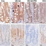 Merck Anti-β-Catenin antibody produced in rabbit