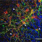 Merck Anti-Substance P Receptor antibody produced in rabbit