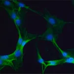 Merck Anti-Myosin IIA, non muscle antibody produced in rabbit