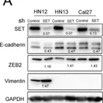 Merck Anti-Vimentin antibody, Mouse monoclonal