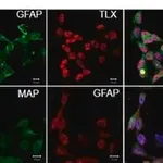 Merck Anti-MAP2 (2a+2b) antibody, Mouse monoclonal