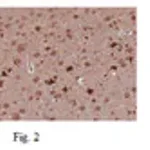 Merck Anti-GluR2 Antibody