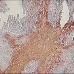 Merck Anti-Chondroitin Sulfate antibody, Mouse monoclonal