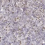 Merck Anti-TBX19 antibody produced in rabbit