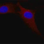 Merck Anti-MAP Kinase, Activated (Diphosphorylated ERK-1&2) antibody, Mouse monoclonal