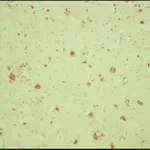 Merck Anti-β-Amyloid antibody, Mouse monoclonal