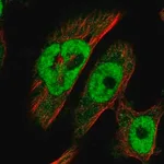 Merck Anti-BRCA2 antibody produced in rabbit