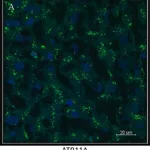 Merck Anti-ATP11A antibody produced in rabbit