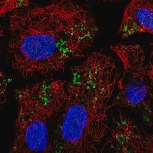 Merck Anti-PNPLA2 antibody produced in rabbit
