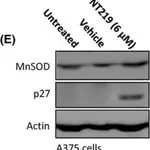 Merck Anti-Mn-SOD Antibody