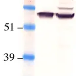 Merck Anti-Retinal Pigment Epithelium 65 Antibody