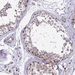 Merck Anti-TCOF1 antibody produced in rabbit