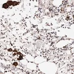 Merck Anti-PTPN22 antibody produced in rabbit