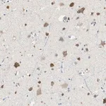 Merck Anti-RORB antibody produced in rabbit