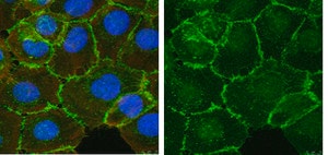 Merck Anti-β-Catenin Antibody