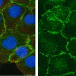 Merck Anti-β-Catenin Antibody