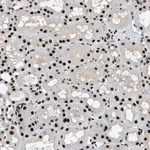 Merck Anti-ZBTB20 antibody produced in rabbit