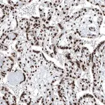 Merck Anti-BRD4 antibody produced in rabbit