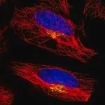 Merck Anti-ATP7A antibody produced in rabbit