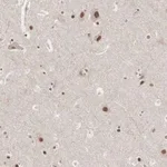 Merck Anti-AUTS2 antibody produced in rabbit