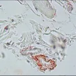 Merck Monoclonal Anti-Elastin antibody produced in mouse
