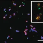 Merck Anti-Brain lipid binding protein Antibody