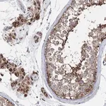 Merck Anti-NGLY1 antibody produced in rabbit