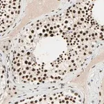 Merck ANTI-CDK12 antibody produced in rabbit