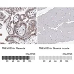 Merck Anti-TMEM165 antibody produced in rabbit