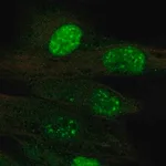 Merck Anti-TERT antibody produced in rabbit