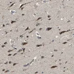 Merck Anti-TRAK1 antibody produced in rabbit