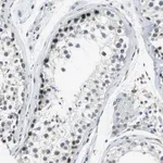Merck Anti-ECD antibody produced in rabbit