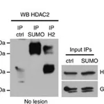 Merck Anti-Histone Deacetylase 2 (HDAC2) antibody, Mouse monoclonal