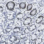 Merck Anti-DACH1 antibody produced in rabbit
