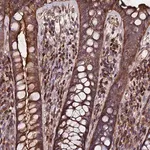 Merck Anti-EXT1 antibody produced in rabbit