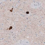 Merck Anti-CHAT antibody produced in rabbit