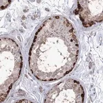 Merck Anti-STT3B antibody produced in rabbit
