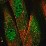 Merck Anti-NLRP1 antibody produced in rabbit
