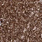 Merck Anti-ERBB2 antibody produced in rabbit