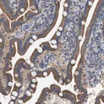 Merck Anti-VPS13A antibody produced in rabbit