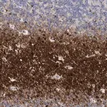 Merck Anti-ATP10B antibody produced in rabbit