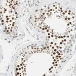 Merck Anti-MLLT10 antibody produced in rabbit